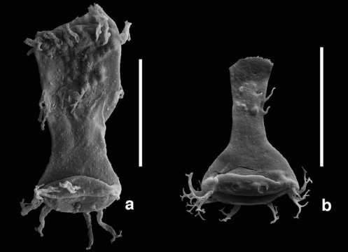기형 (a) 과 정상 (b) 플랑크톤. 독성 금속 오염이 고대 해양에서 일어난 많은, 혹은 모든 멸종 사건에 기여한 요인이었을 수도 있다. Credit: Image courtesy of Ghent University