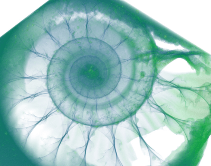 보훔 루르 대학교의 연구자들은 고해상도 엑스레이 방사선을 이용해 멸종한 해양생물들이 어떻게 살았는지 연구한다. Credit: ⓒ RUBIN, image: Rene Hoffmann