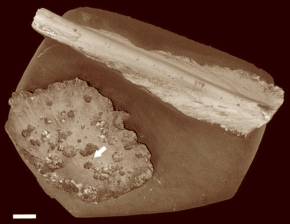 1억년 된 바다거북 뼈를 CT 스캔하여 재구성한 것. 화살표가 가리키는 것이 고대의 오세닥스 벌레가 파먹은 자국이다. 스케일바는 1cm 길이. Image credit: Silvia Danise / Nicholas Higgs.