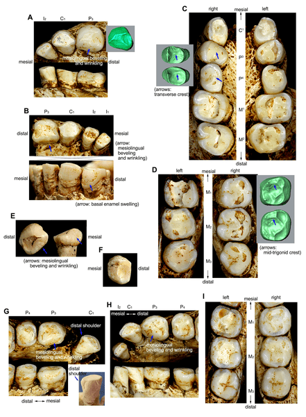 호모 플로레시엔시스의 치아. Credit: PLOS ONE (2015). DOI: 10.1371/journal.pone.0141614
